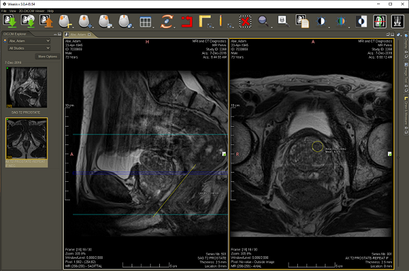 DICOM Viewer screenshot