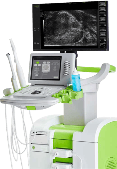 ExactVu Micro-Ultrasound system ExactVu Micro-Ultrasound system